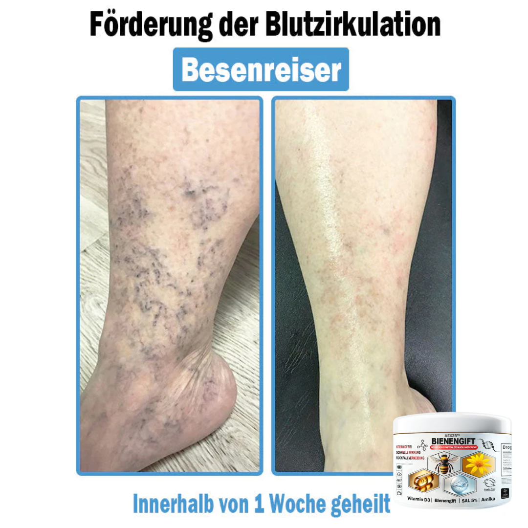 AEXZR™🌿 Bienengift Multisymptom Behandlungsscreme (👨⚕DDG Empfohlen)