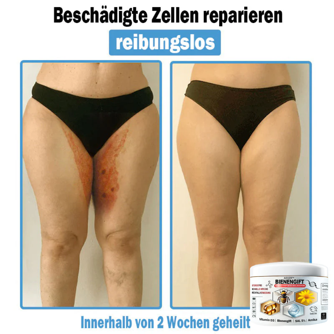 AEXZR™🌿 Bienengift Multisymptom Behandlungsscreme (👨⚕DDG Empfohlen)