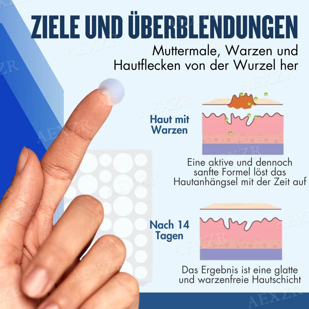 Skinetiv™ Maulwürfe & Warzen entfernen Haut-Tag-Pflaster