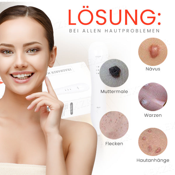 Hudfil™ 🔥 2025 Neuestes Modell🔥𝔾𝕖𝕟𝕚𝕖ß𝕖𝕟 𝕊𝕚𝕖 𝟟𝟘 % 🆁🅰🅱🅰🆃🆃 - Tragbarer Hautpflege-Laserstift