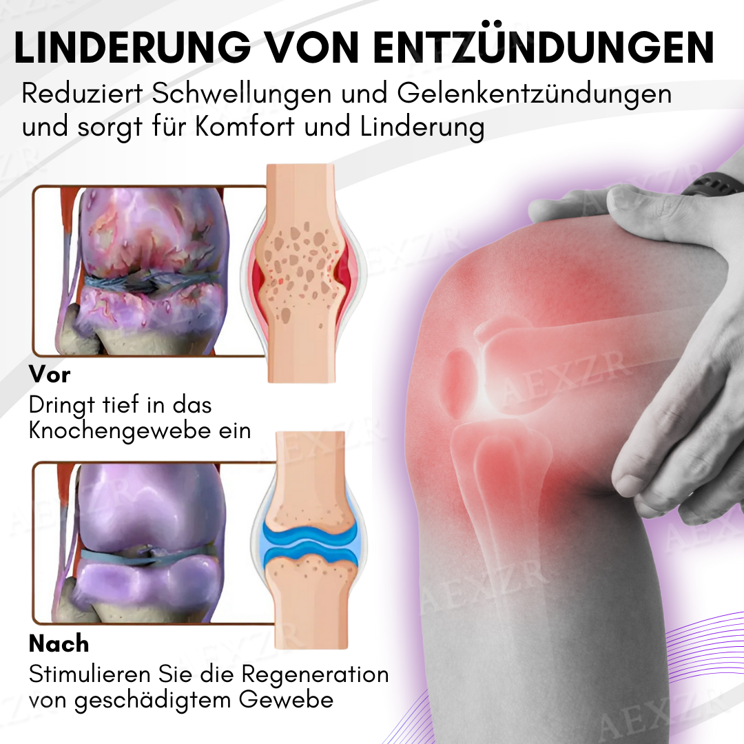TurmaCure™ Kurkuma & Emu-Öl Arthritis Beruhigendes Schmerzlinderungs Massagegel
