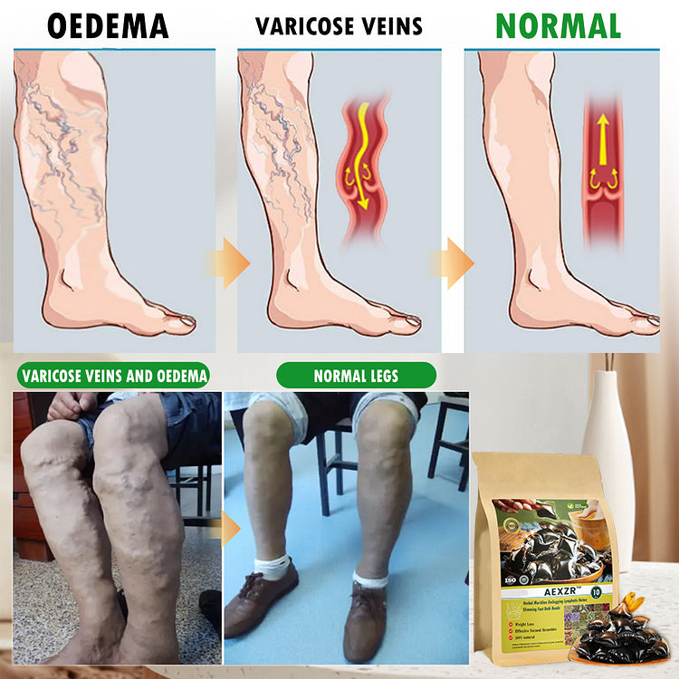 2024 HEISSER VERKAUFđ„AEXZRâą KrĂ€uter-Meridian Unclogging Lymphatic Detox Schlankheits FuĂbad Perlenđ„