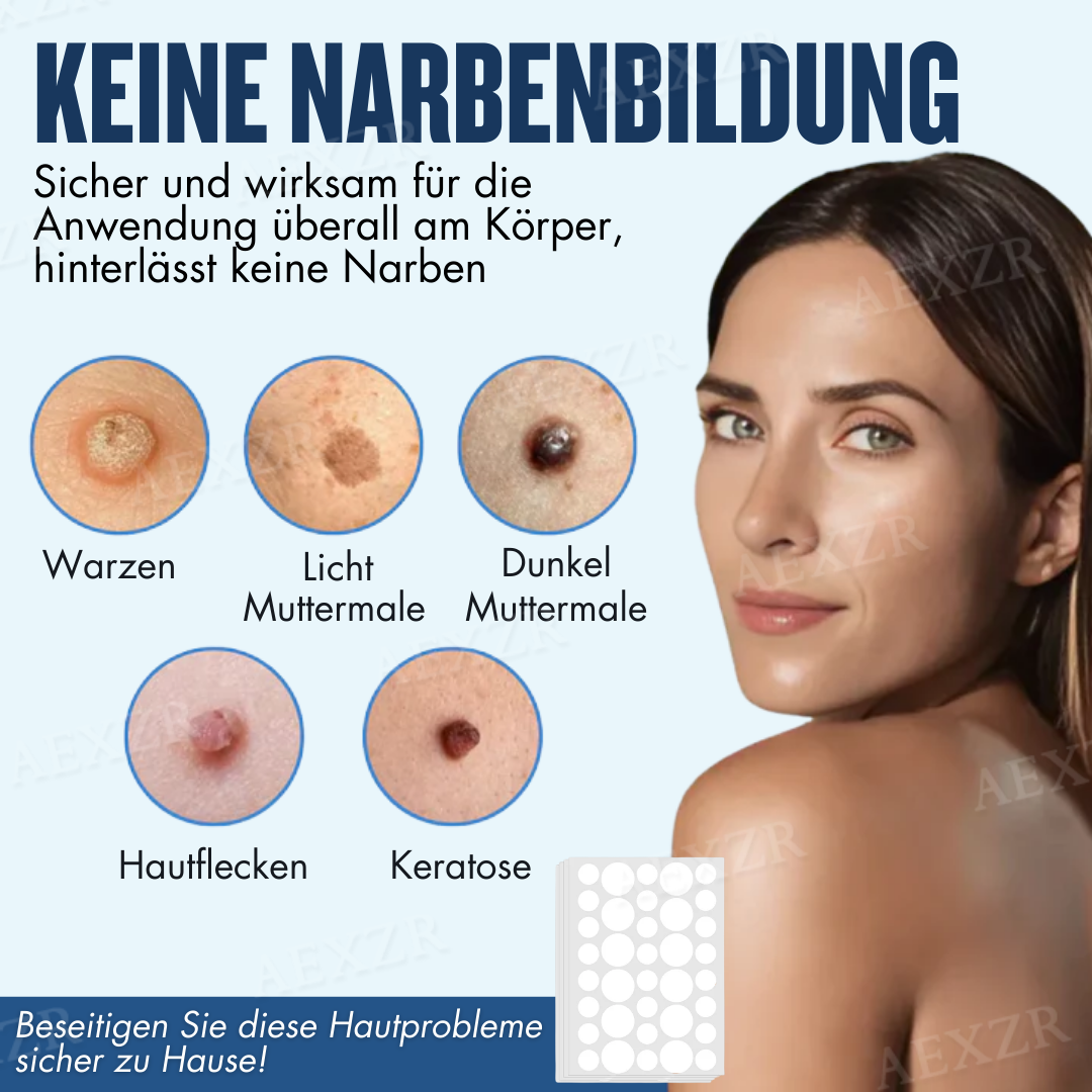 Skinetiv™ Maulwürfe & Warzen entfernen Haut-Tag-Pflaster