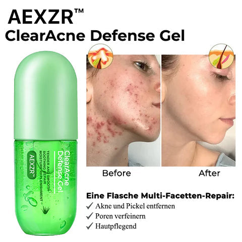 AEXZR™ ClearAcne Abwehr Gel