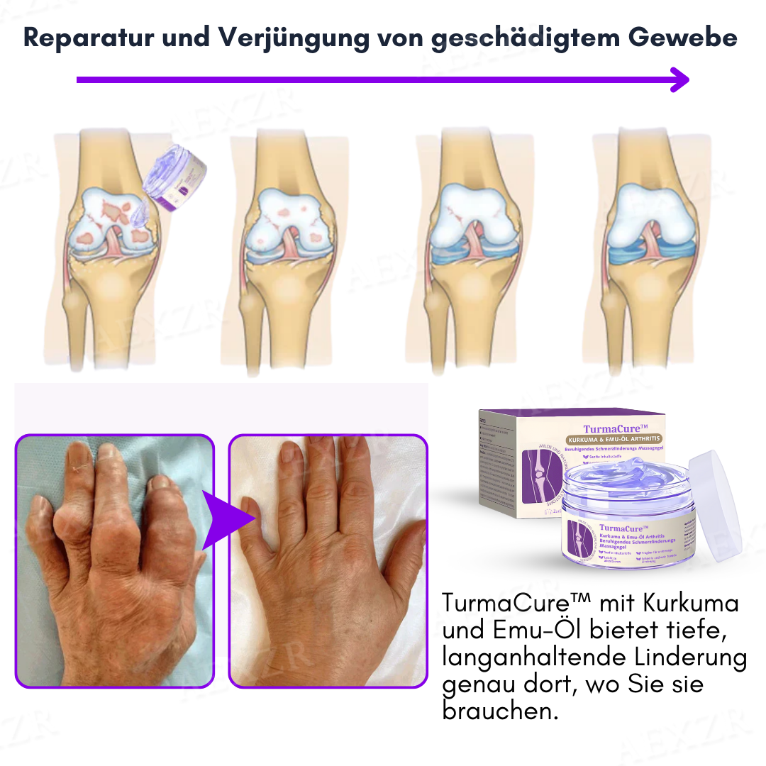 TurmaCure™ Kurkuma & Emu-Öl Arthritis Beruhigendes Schmerzlinderungs Massagegel