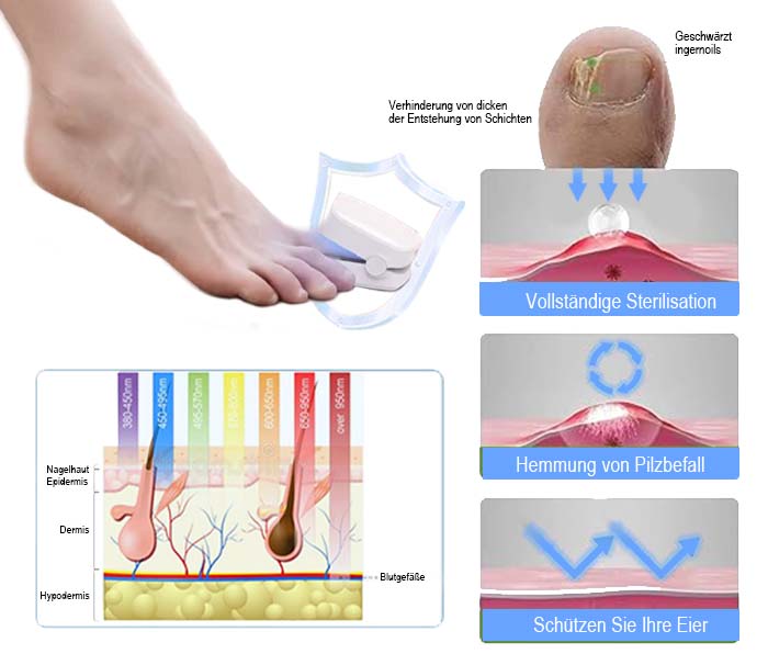 Bikenda® Revolutionäres hocheffizientes Lichttherapiegerät für Zehennagelerkrankungen (⭐⭐⭐⭐⭐ Begrenzter Rabatt für 30 Minuten)