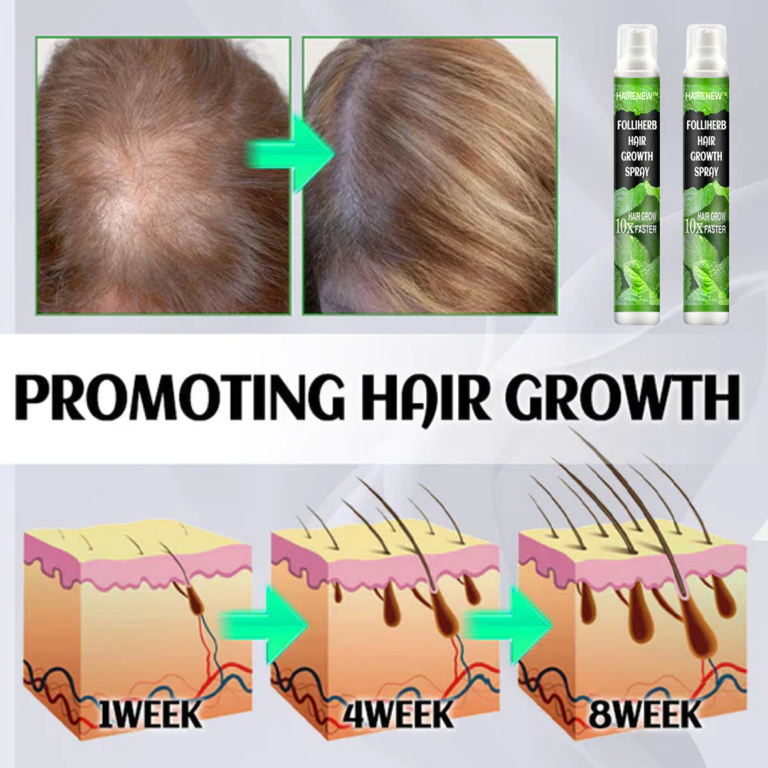 🧔🏻♀️6.000 verkaufte Flaschen pro Tag in Europa🧔🏻♀️HAIRENEW™ FolliHerb Haarwuchs Spray