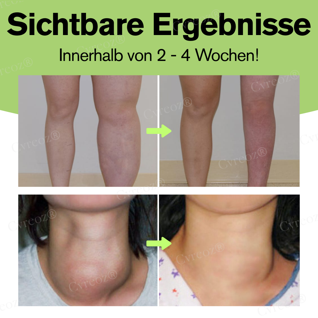 Cvreoz® Kräuter Lymphatische Entgiftung Creme