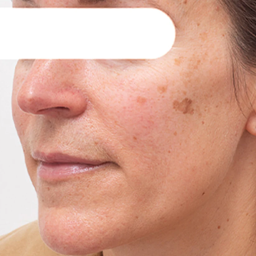 AEXZR® Herbal Flecken Peel-Off Gesichtsmaske