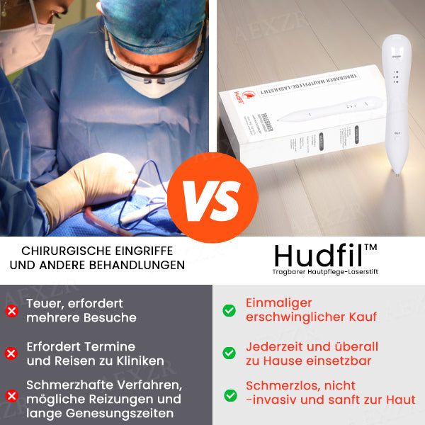 Hudfil™ 🔥 2025 Neuestes Modell🔥𝔾𝕖𝕟𝕚𝕖ß𝕖𝕟 𝕊𝕚𝕖 𝟟𝟘 % 🆁🅰🅱🅰🆃🆃 - Tragbarer Hautpflege-Laserstift