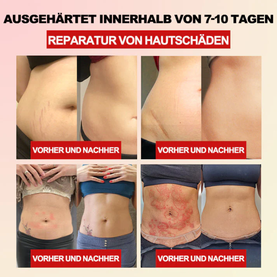 AEXZR™ Fiber und Wermut Körperformende Taillenstütze 💁♀️ (Empfohlen von plastischen Chirurgen)