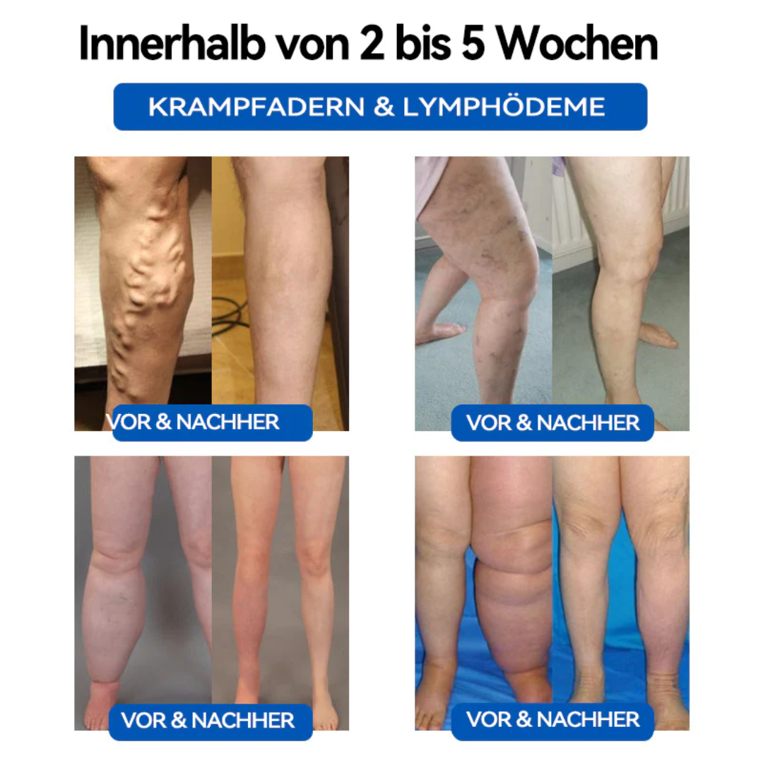 AEXZR™ Ultraschall-Fettzerstörung & Ferninfrarot-Blut-Zucker-Balance-Detox-Armband(Schönheitschirurg empfiehlt