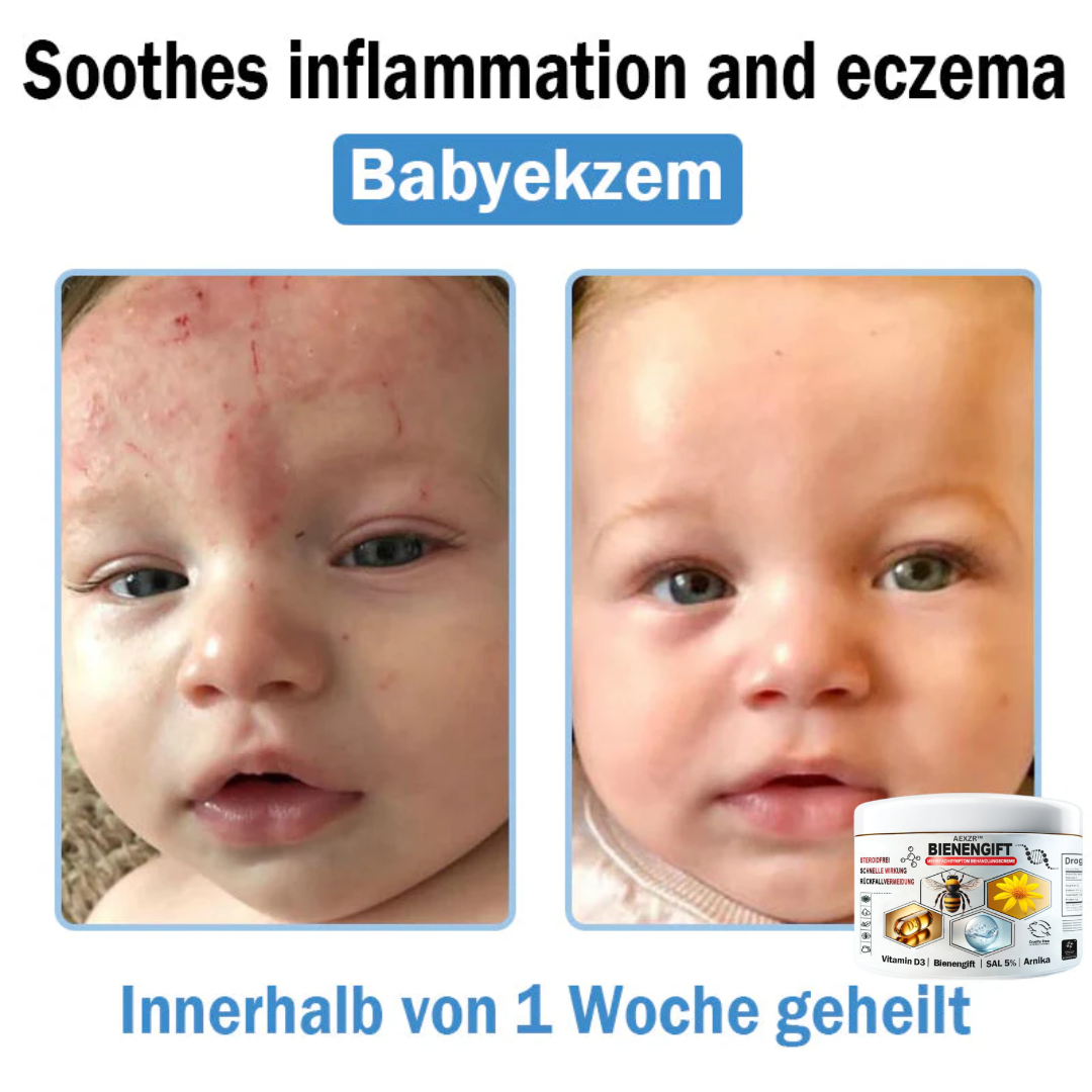 AEXZR™🌿 Bienengift Multisymptom Behandlungsscreme (👨⚕DDG Empfohlen)
