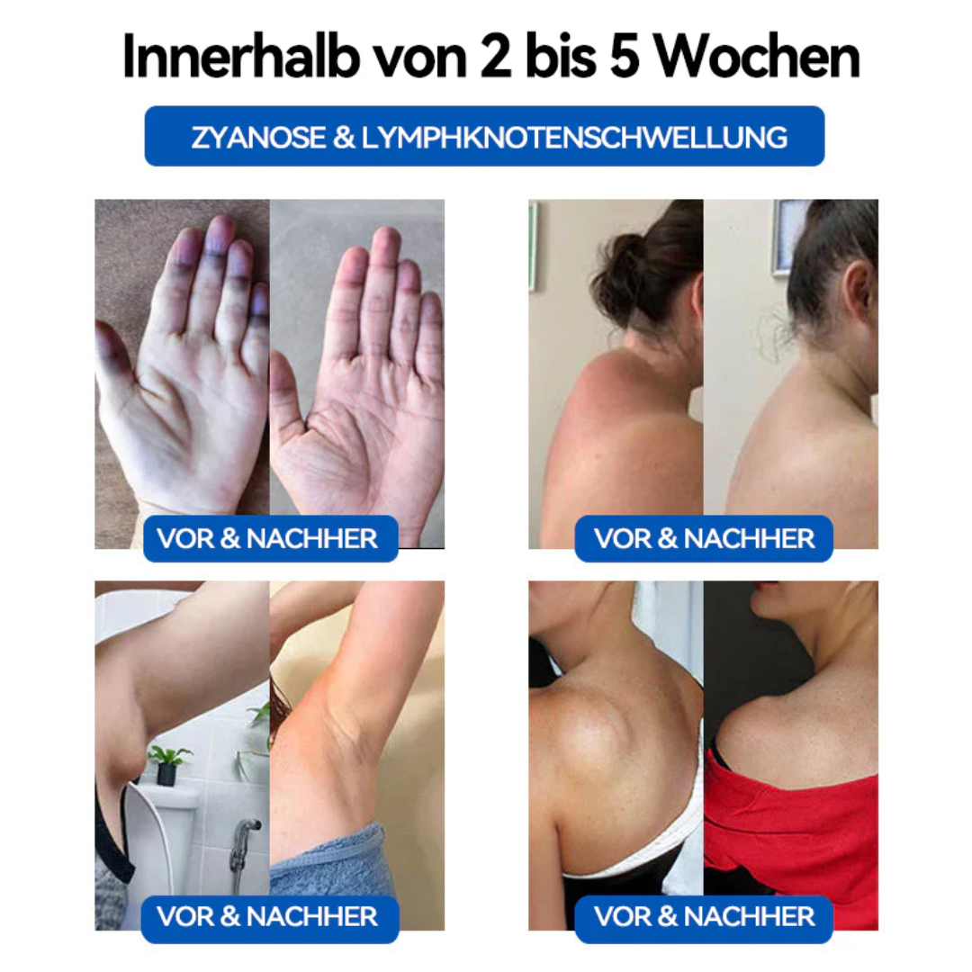 AEXZR™ Ultraschall-Fettzerstörung & Ferninfrarot-Blut-Zucker-Balance-Detox-Armband(Schönheitschirurg empfiehlt