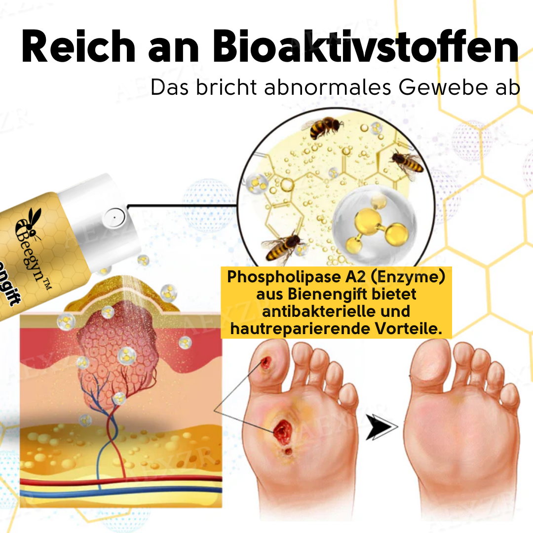 Beegyn™ Bienengift Diabetisches Fußbehandlungsspray