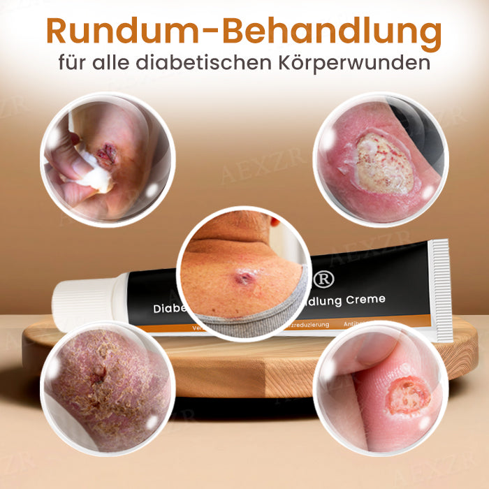Cvreoz® Diabetiker Wunden Behandlung Creme