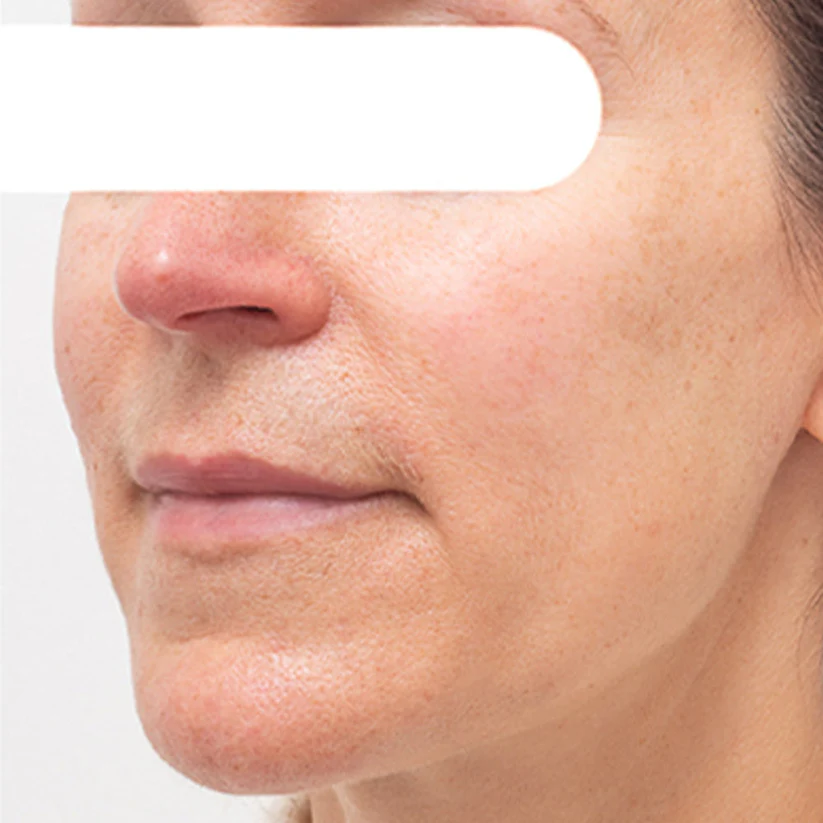 AEXZR® Herbal Flecken Peel-Off Gesichtsmaske