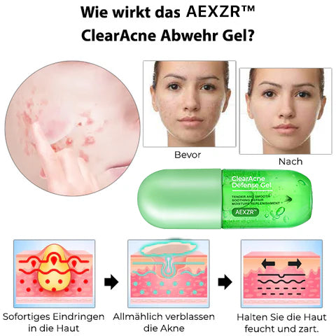 AEXZR™ ClearAcne Abwehr Gel
