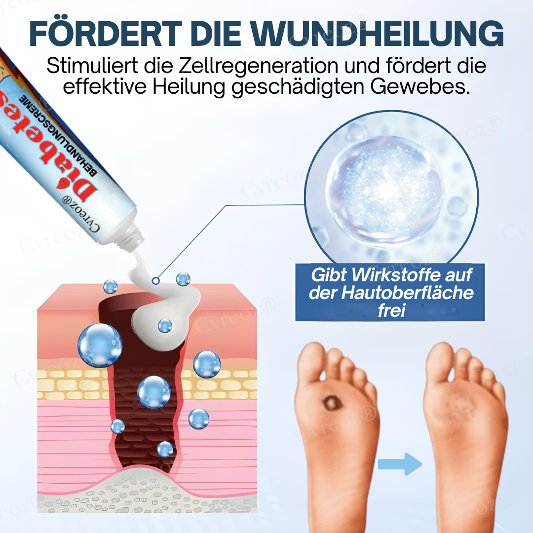 Cvreoz® Diabetes Behandlungscreme