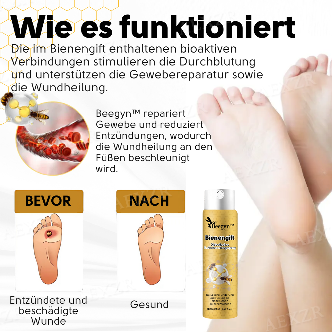 Beegyn™ Bienengift Diabetisches Fußbehandlungsspray