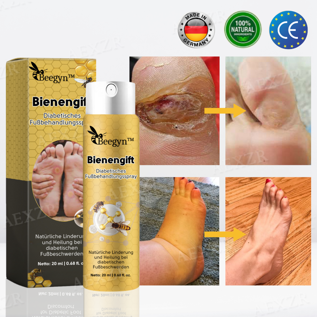 Beegyn™ Bienengift Diabetisches Fußbehandlungsspray