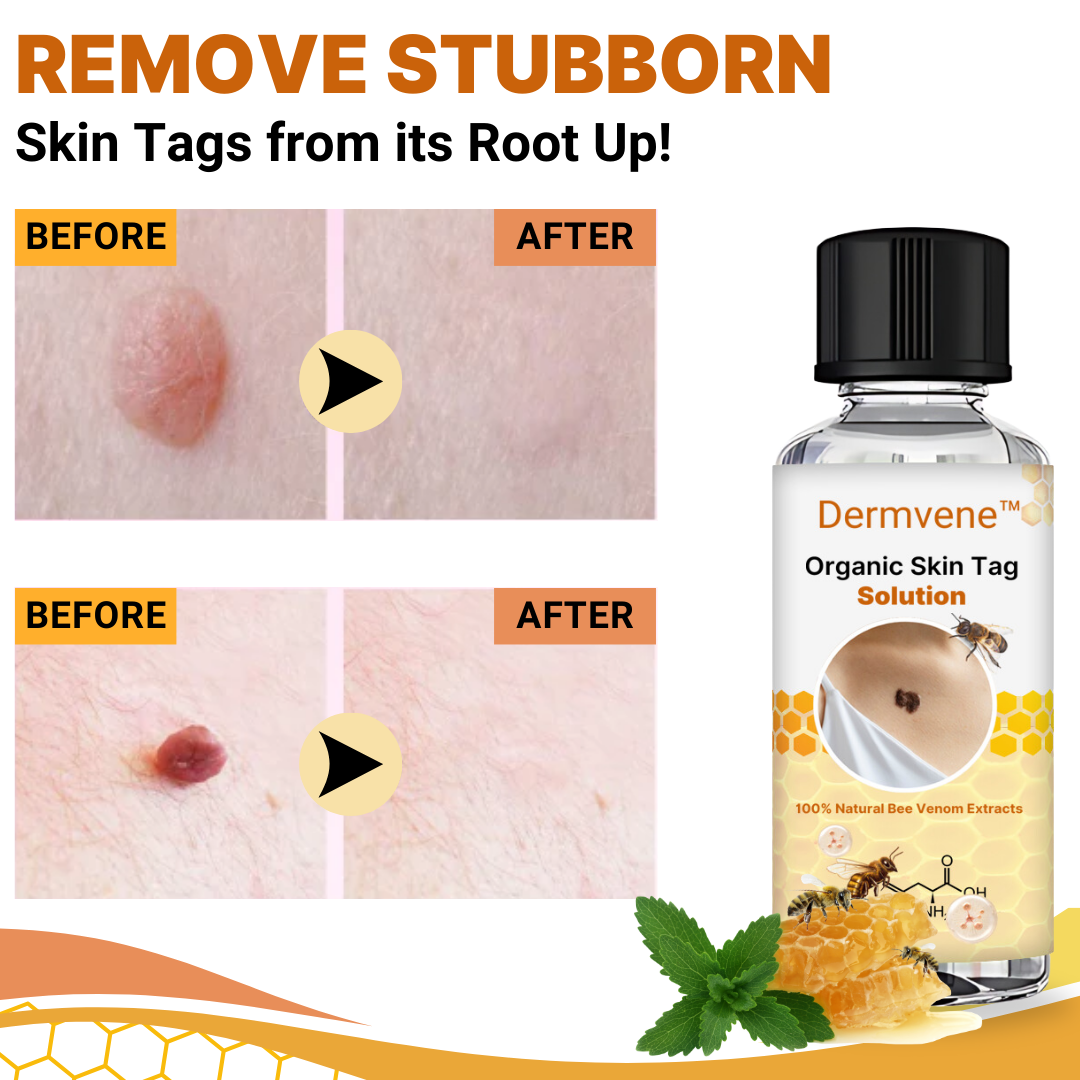 Dermvene™ Organische Haut Tag Lösung
