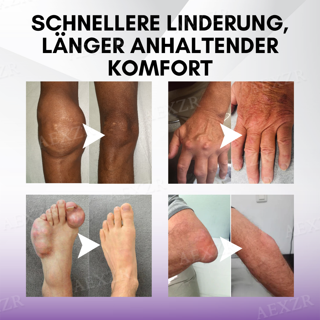 TurmaCure™ Kurkuma & Emu-Öl Arthritis Beruhigendes Schmerzlinderungs Massagegel