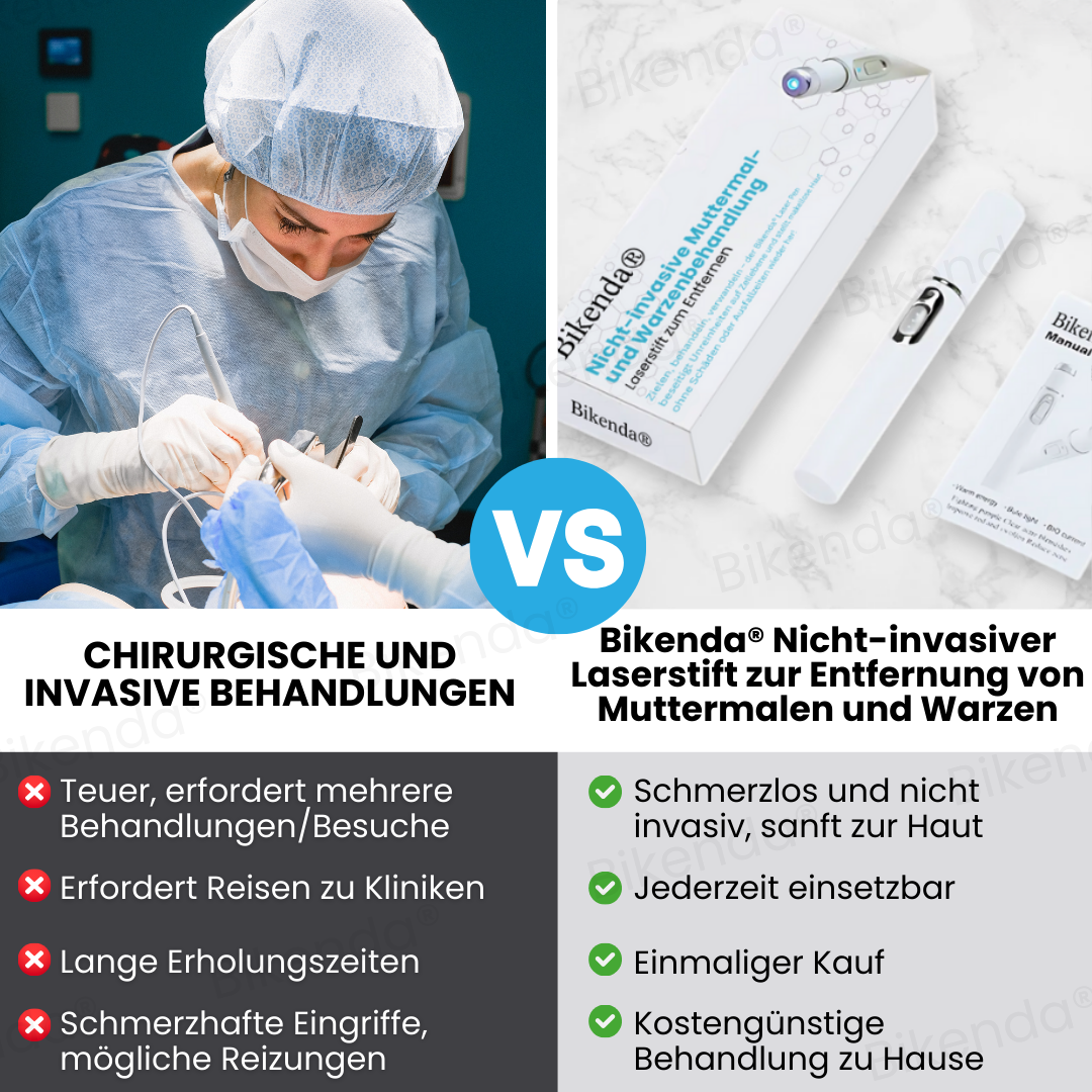 Bikenda® Nicht-invasive Muttermal- und Warzenbehandlung Laserstift zum Entfernen
