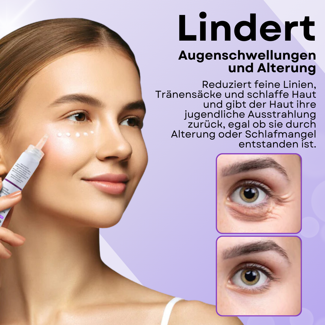 🔥2024 HEISSER VERKAUF🔥AEXZR™ Augenschwellungs Entferner Creme