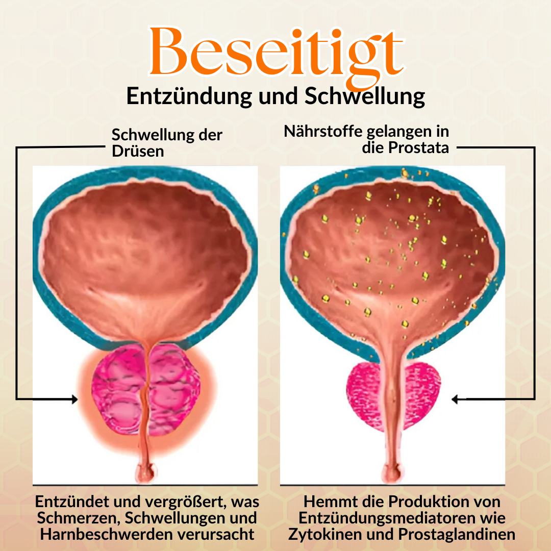 2024 HEISSER VERKAUF🔥BeeProste™ Prostata-Wellness Naseninhalator🔥