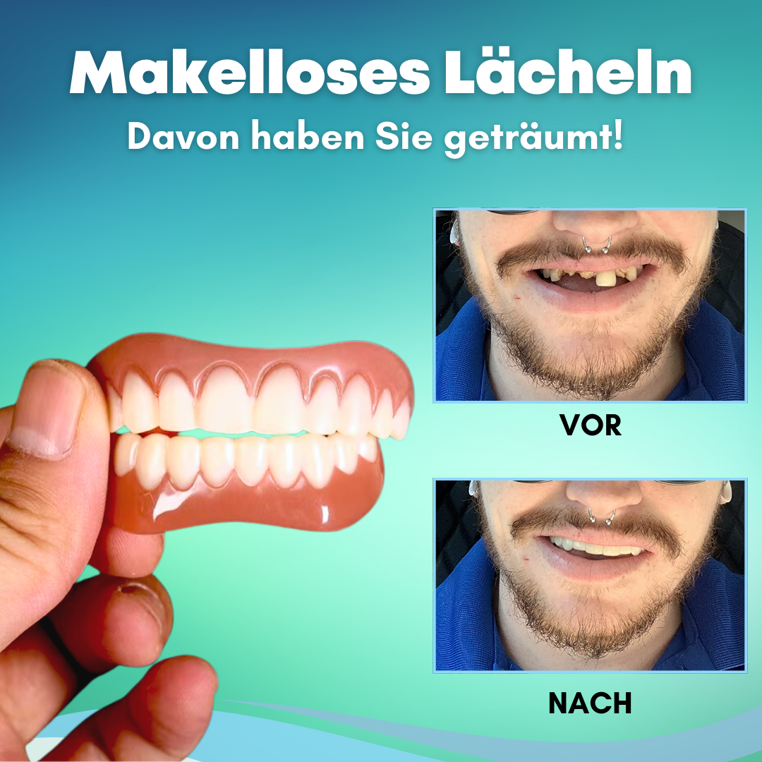 🔥2024 HEISSER VERKAUF🔥EzySmile™ SnapOn Silikon Veneers