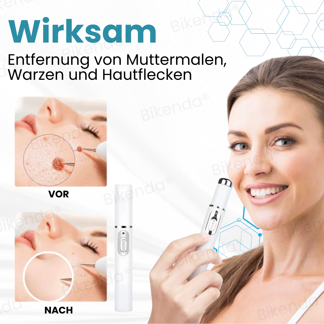 Bikenda® Nicht-invasive Muttermal- und Warzenbehandlung Laserstift zum Entfernen