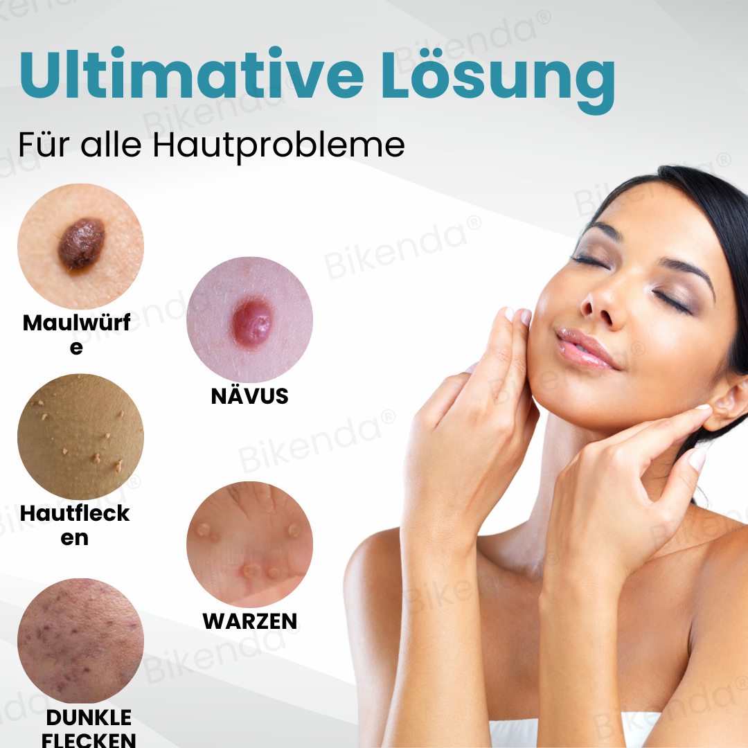 Bikenda® Nicht-invasive Muttermal- und Warzenbehandlung Laserstift zum Entfernen