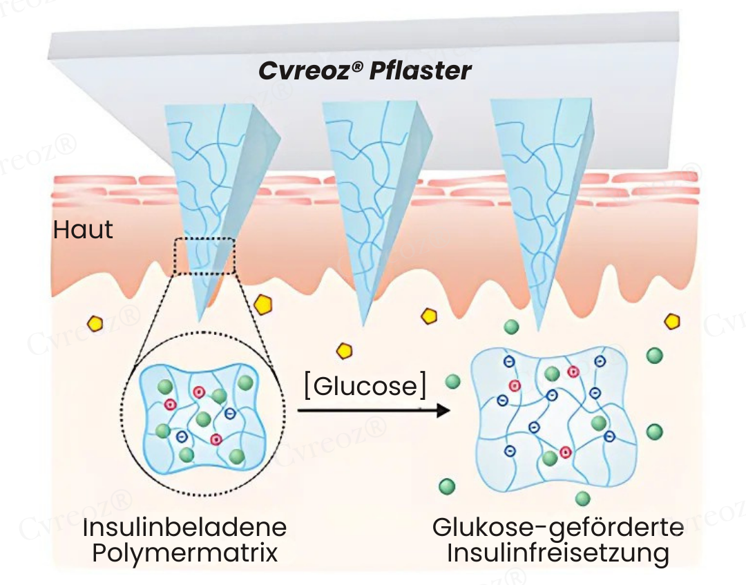 Cvreoz® InsuliNeedle Glukosekontrolle Microneedling-Pflaster