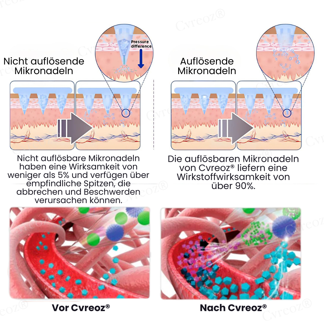 Cvreoz® InsuliNeedle Glukosekontrolle Microneedling-Pflaster