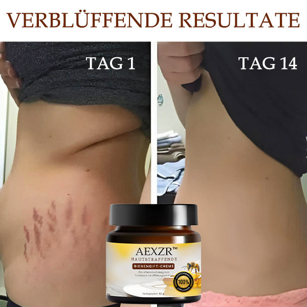 AEXZR™ Hautstraffende Bienengift-Creme