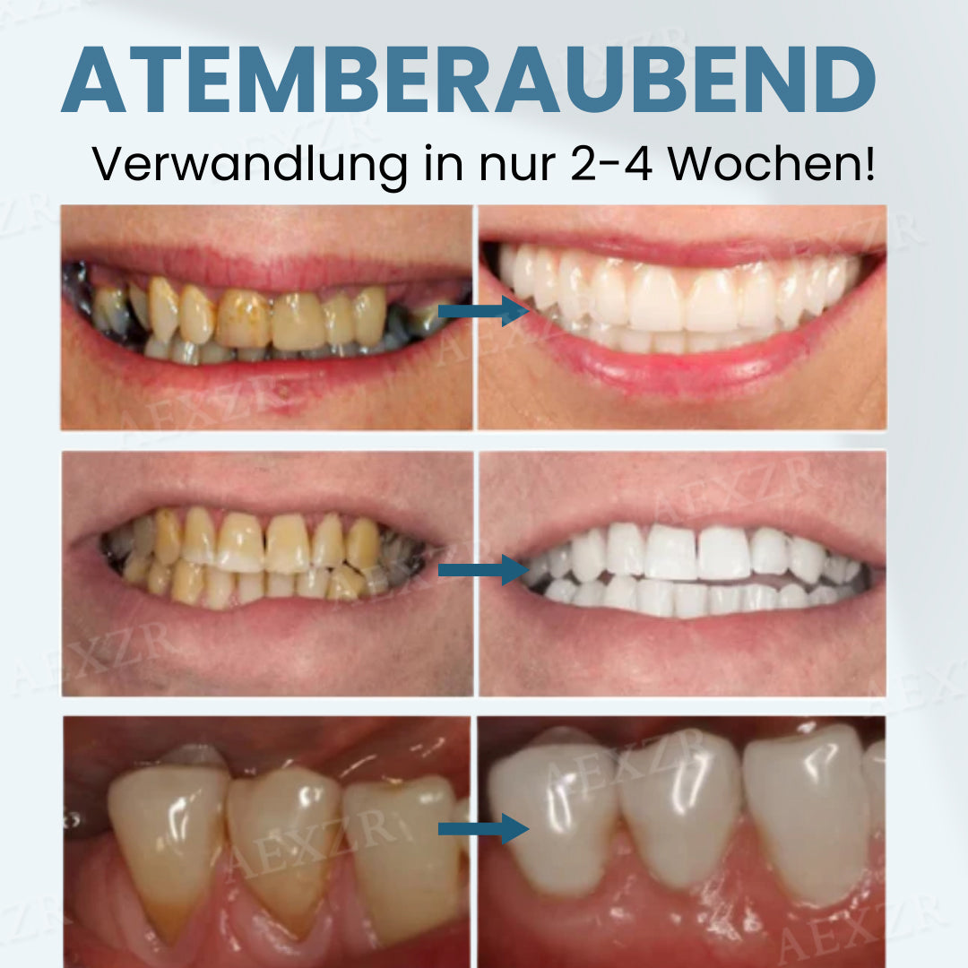Beezau™ Bienengift Pulver zur Zahnrestauration