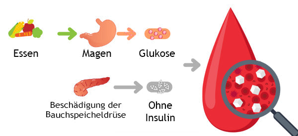 AEXZR™ Diabetes-Fußpads