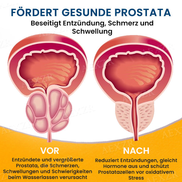 BeeZau™ Prostata-Pflaster