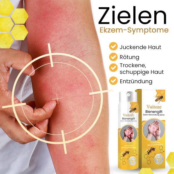 🐝Vuitoze™ Bienengift Ekzem Behandlung Spray🐝Die Wirkung wird in einer Woche eintreten