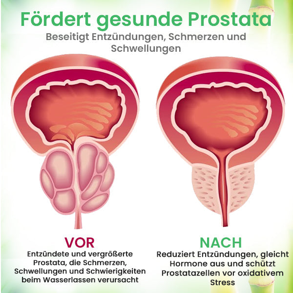 2024 HEISSER VERKAUF🔥AEXZR™ Detox Prostata-Pflaster 🔥