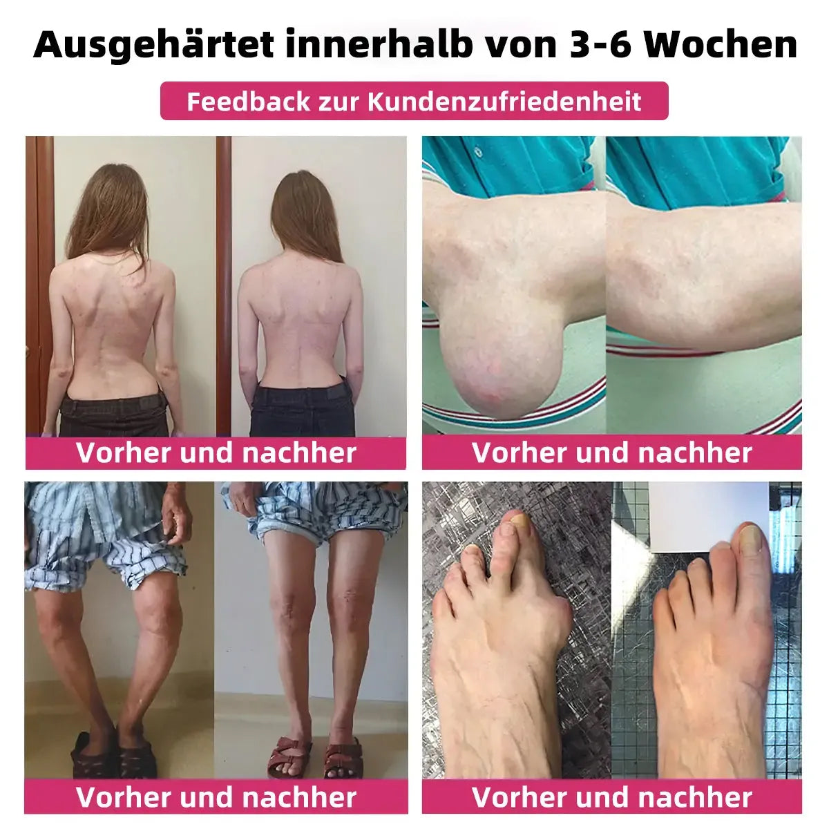 AEXZR™ Bienegift Schmerzlinderungs- Knochenheilungs-Creme