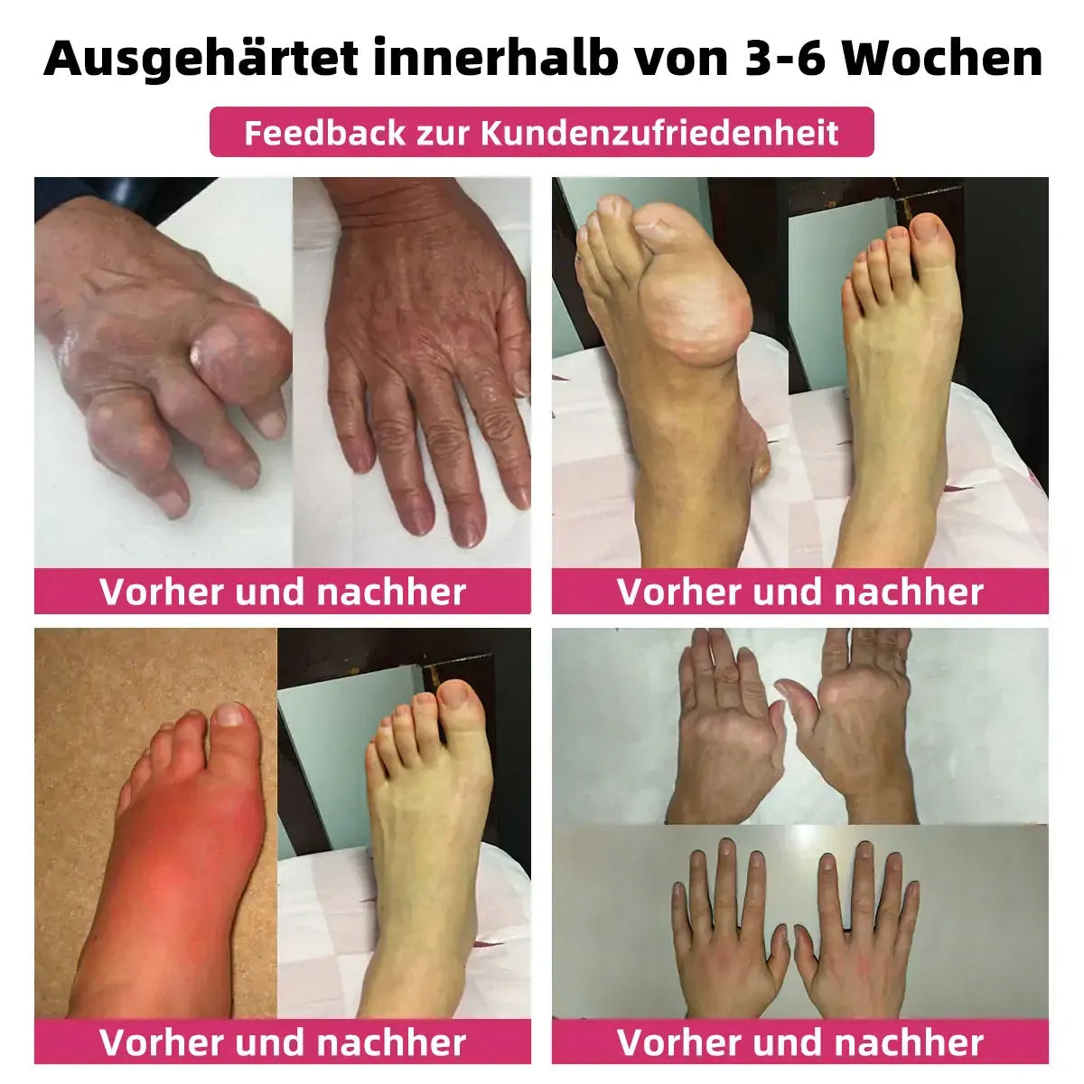 AEXZR™ Bienegift Schmerzlinderungs- Knochenheilungs-Creme