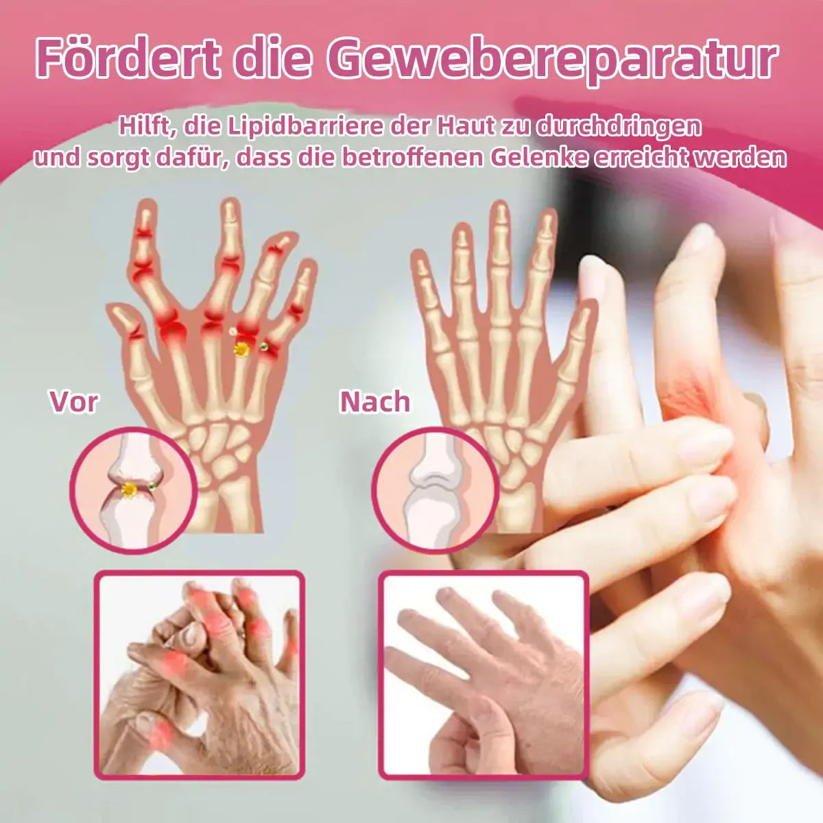 AEXZR™ Bienegift Schmerzlinderungs- Knochenheilungs-Creme