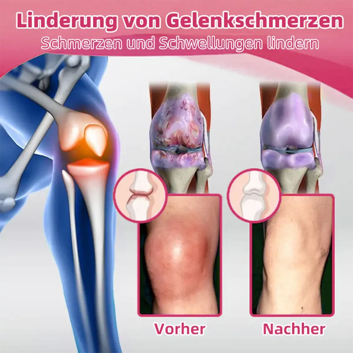 AEXZR™ Bienegift Schmerzlinderungs- Knochenheilungs-Creme