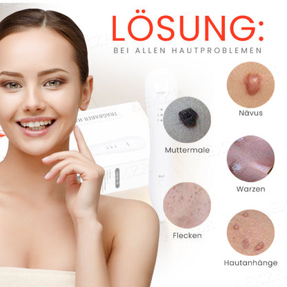 Hudfil™ 🔥 2025 Neuestes Modell🔥𝔾𝕖𝕟𝕚𝕖ß𝕖𝕟 𝕊𝕚𝕖 𝟟𝟘 % 🆁🅰🅱🅰🆃🆃 - Tragbarer Hautpflege-Laserstift