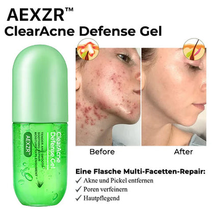 AEXZR™ ClearAcne Abwehr Gel
