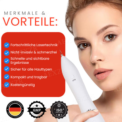 Hudfil™ 🔥 2025 Neuestes Modell🔥𝔾𝕖𝕟𝕚𝕖ß𝕖𝕟 𝕊𝕚𝕖 𝟟𝟘 % 🆁🅰🅱🅰🆃🆃 - Tragbarer Hautpflege-Laserstift