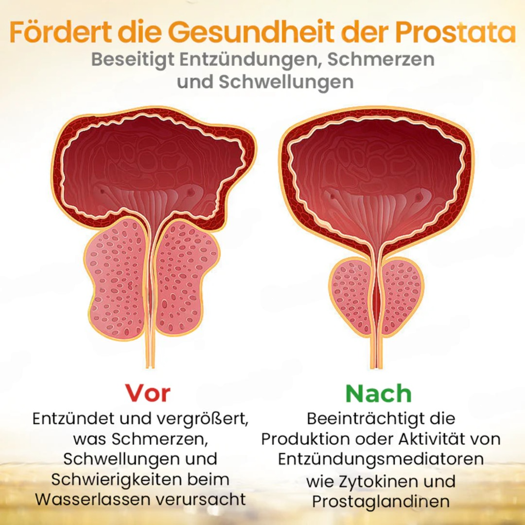 2024 HEISSER VERKAUF🔥AEXZR™ Bee Detox Prostatapflegepflaster🔥