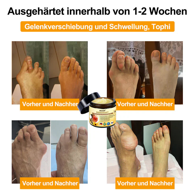 AEXZR™ Bienengift-Schmerzlinderungs Knochenheilungs Creme